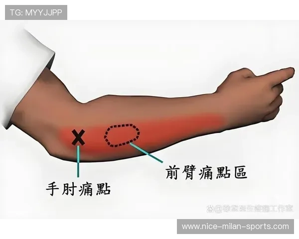 网球肘：不只是网球运动员会得，网球肘会严重吗